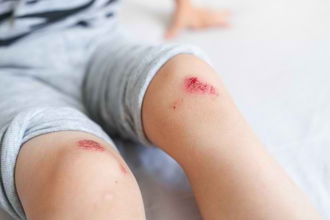 anda-sedang-mengalami-luka-lama-sembuh-mungkin-ini-penyebabnya